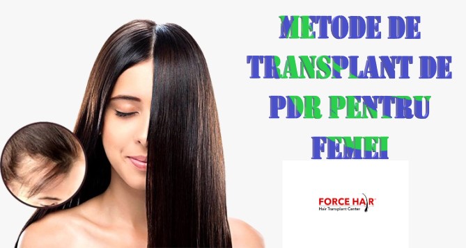 Metode de transplant de păr pentru femei