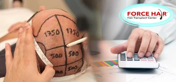 Clinica de Transplant de Par Galati