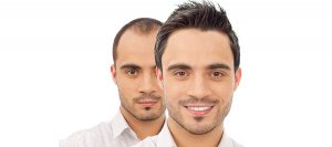 Clinica de transplant de par Bacau